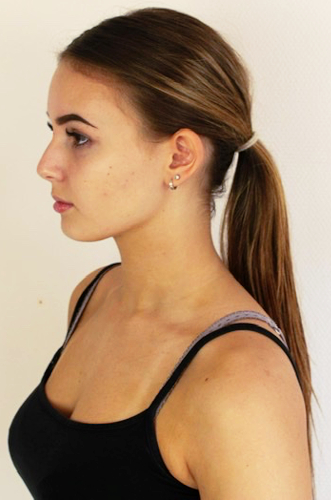Louisa
